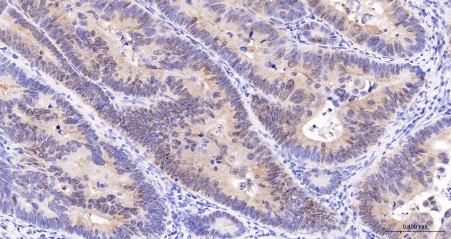 磷酸化原癌基因Yes相关蛋白1重组兔单抗