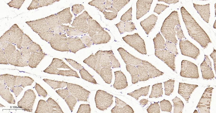 肌钙集蛋白/收钙素重组兔单抗