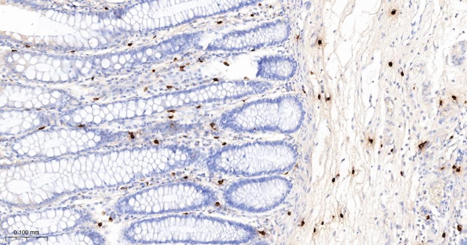 肥大细胞类糜蛋白酶1重组兔单抗