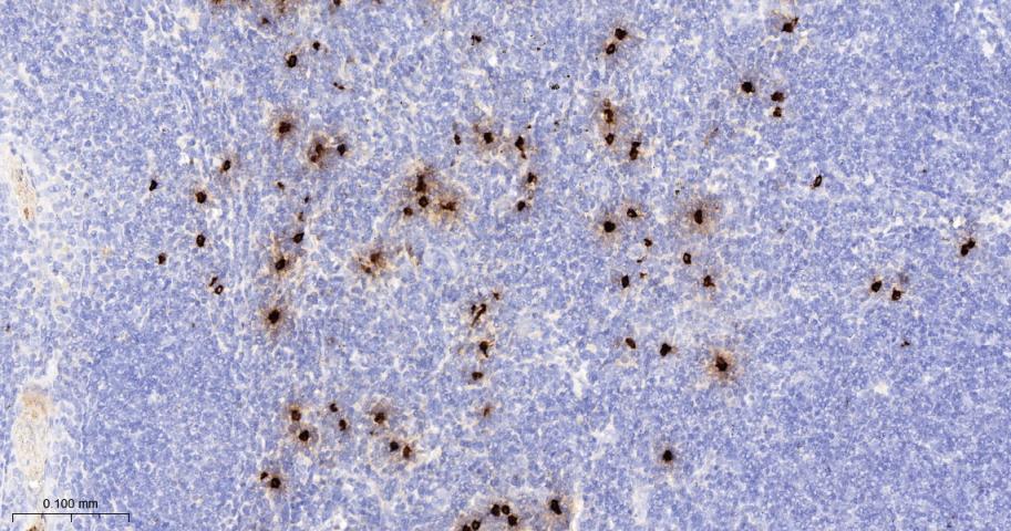 肥大细胞类糜蛋白酶1重组兔单抗