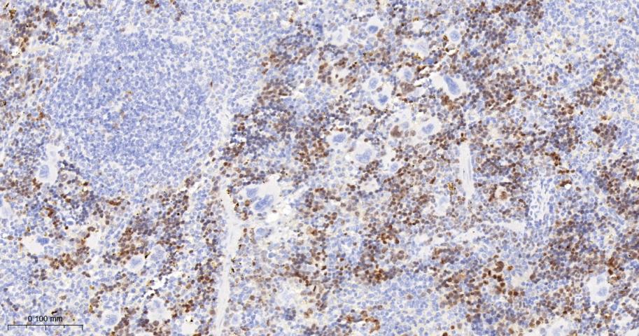 细胞凋亡抑制因子重组兔单抗