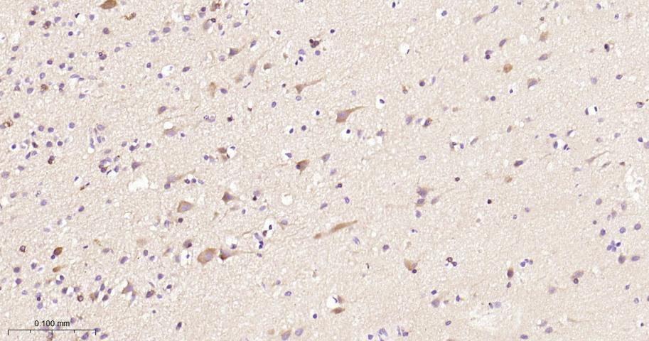 丝氨酸/苏氨酸蛋白激酶39重组兔单抗