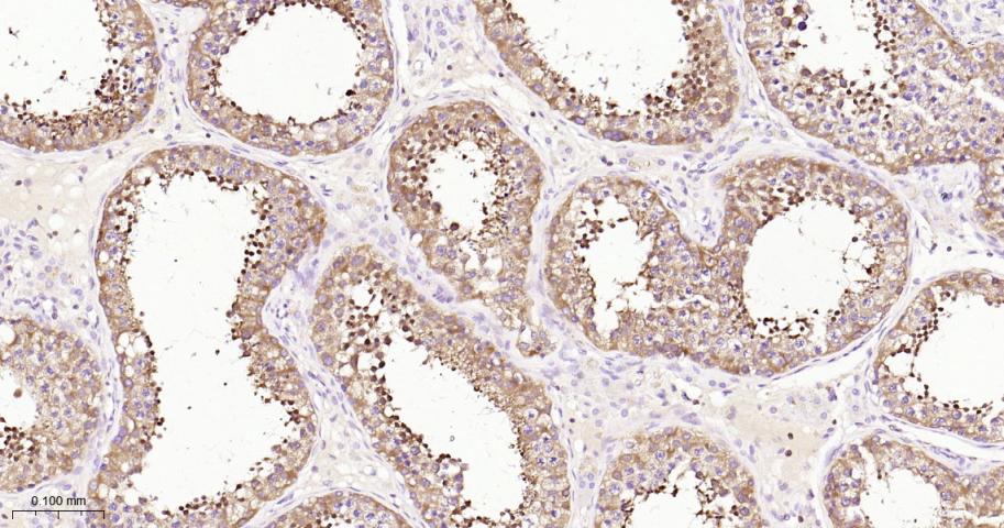 丝氨酸/苏氨酸蛋白激酶39重组兔单抗