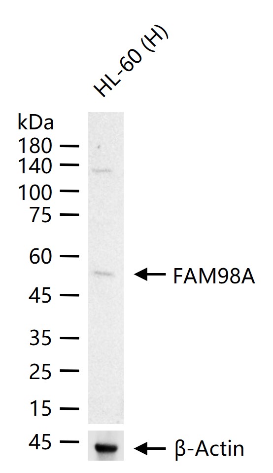 FAM98A Rabbit pAb (一抗) - WB,IHC-P,IHC-F,IF,Flow-Cyt | Bioss