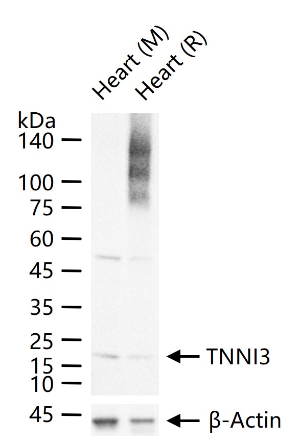 心肌肌钙蛋白重组兔单抗