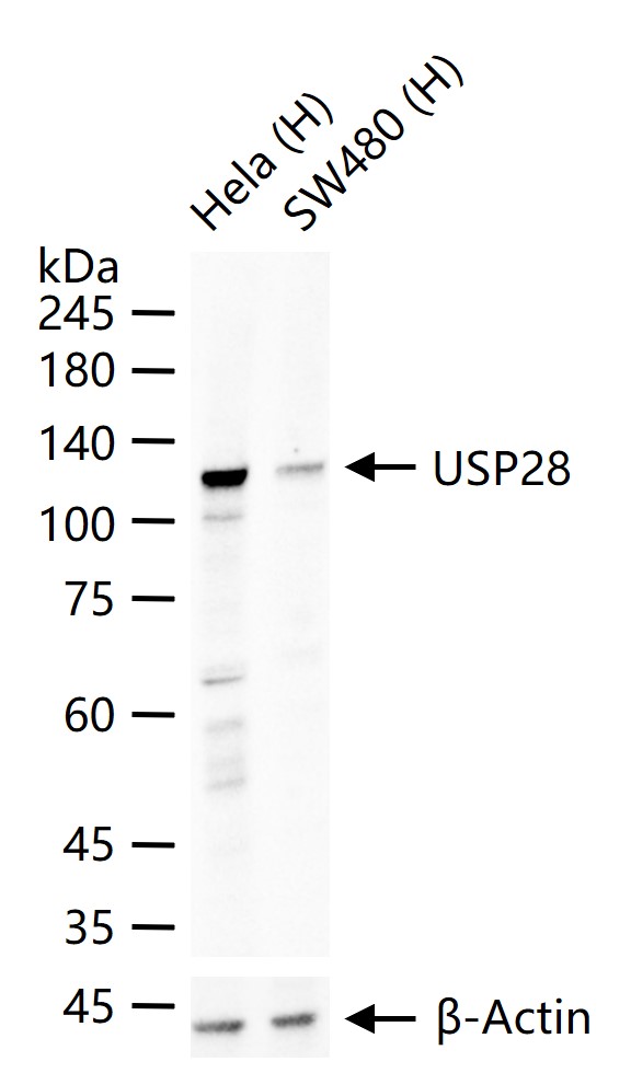 泛素特异性蛋白酶28重组兔单抗