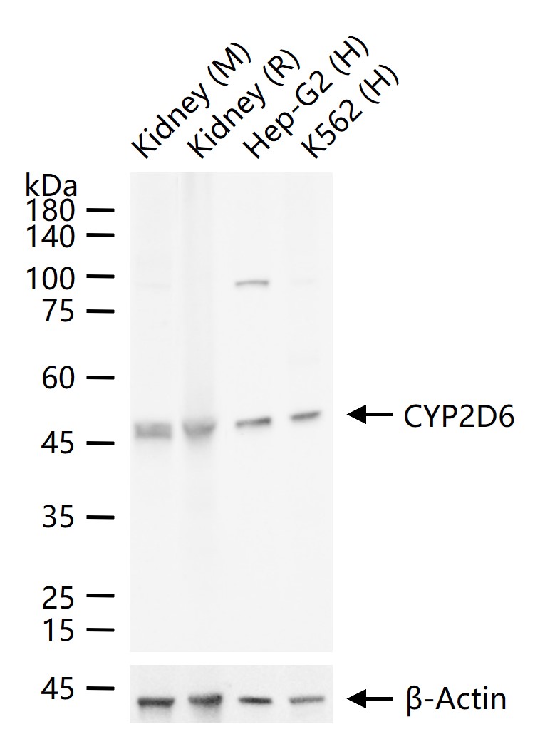CYP2D6 Recombinant Rabbit mAb (一抗) - WB,IHC-P,IHC-F,IF,Flow-Cyt,ICC/IF | Bioss
