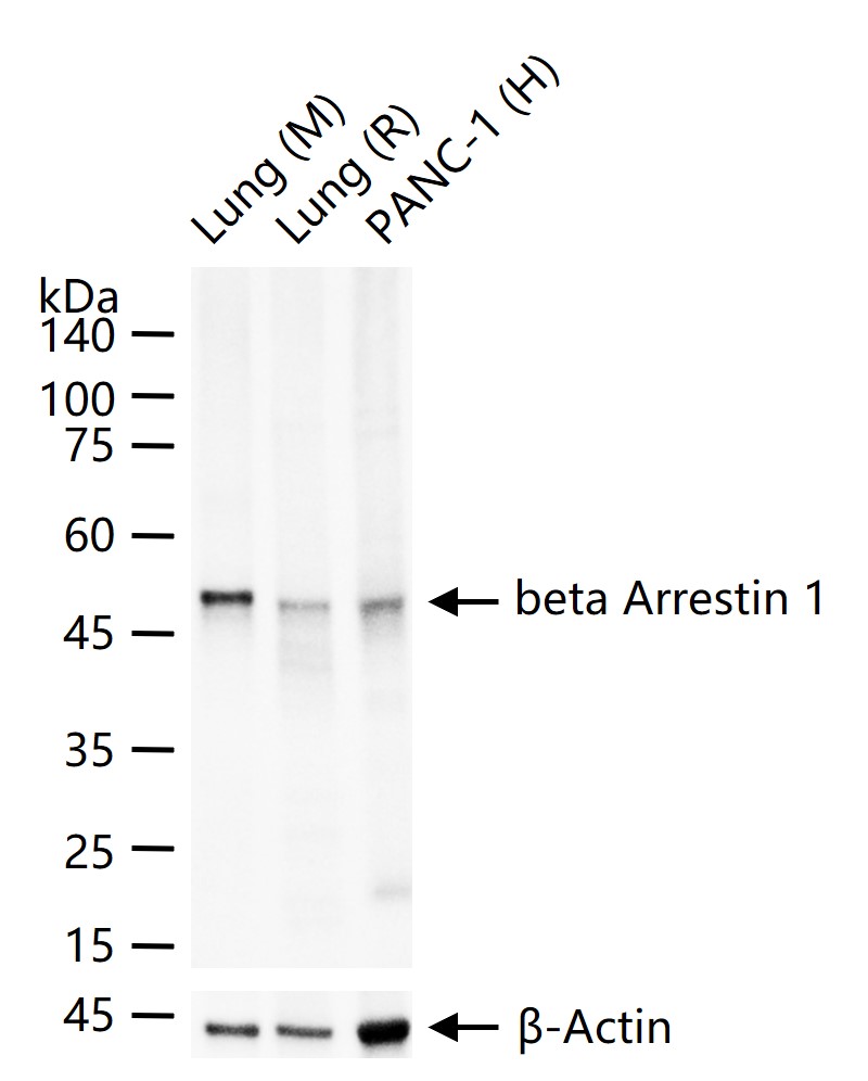 β-抑制蛋白1重组兔单抗-bsm-61185R
