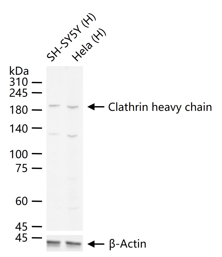 Clathrin heavy chain Rabbit pAb (一抗) - WB,ICC/IF | Bioss