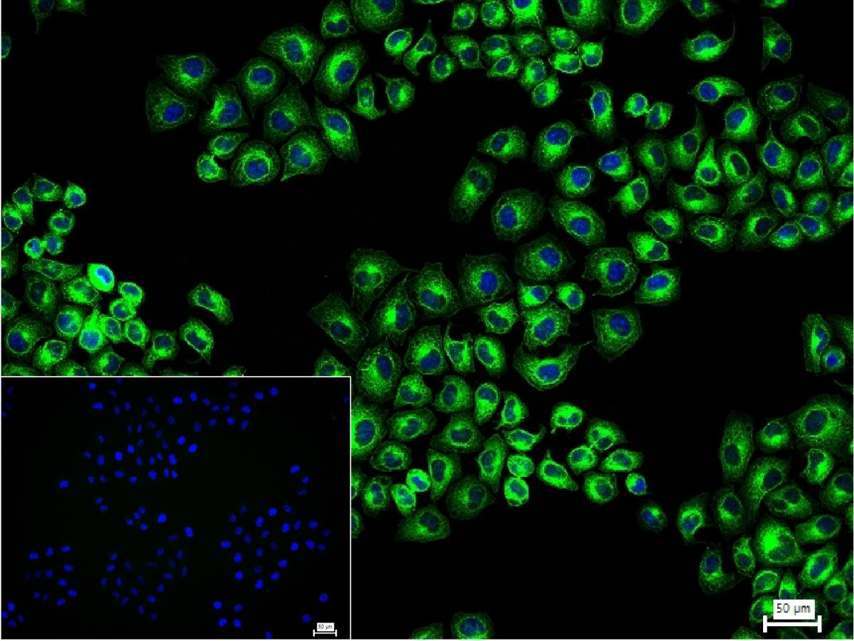 微管蛋白β tubulin/Tubulin β(内参)重组兔单抗