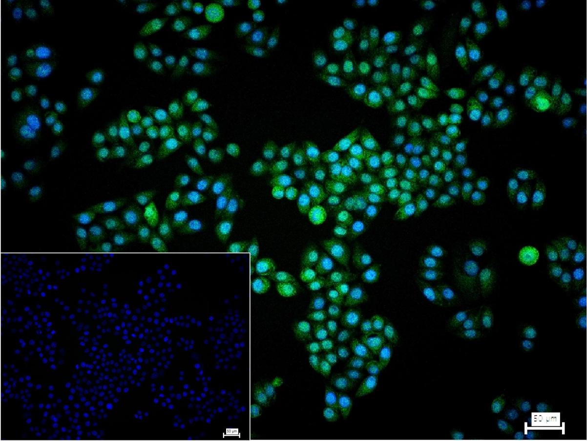 信号转导与转录激活因子1重组兔单抗