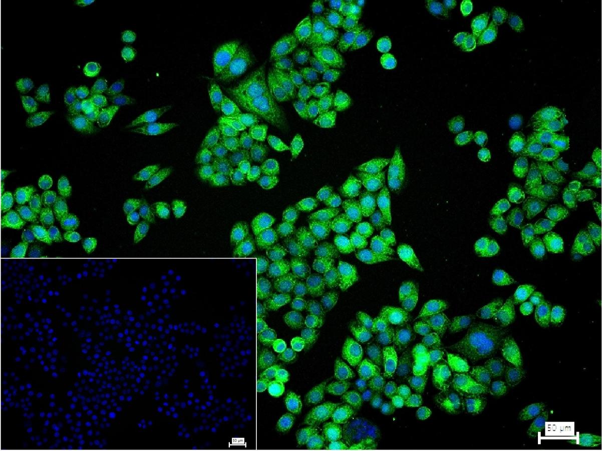 白血病相关蛋白18/癌蛋白18重组兔单抗