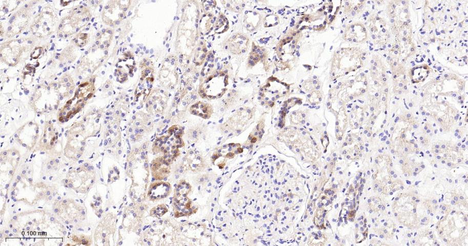 丝氨酸/苏氨酸蛋白激酶39重组兔单抗