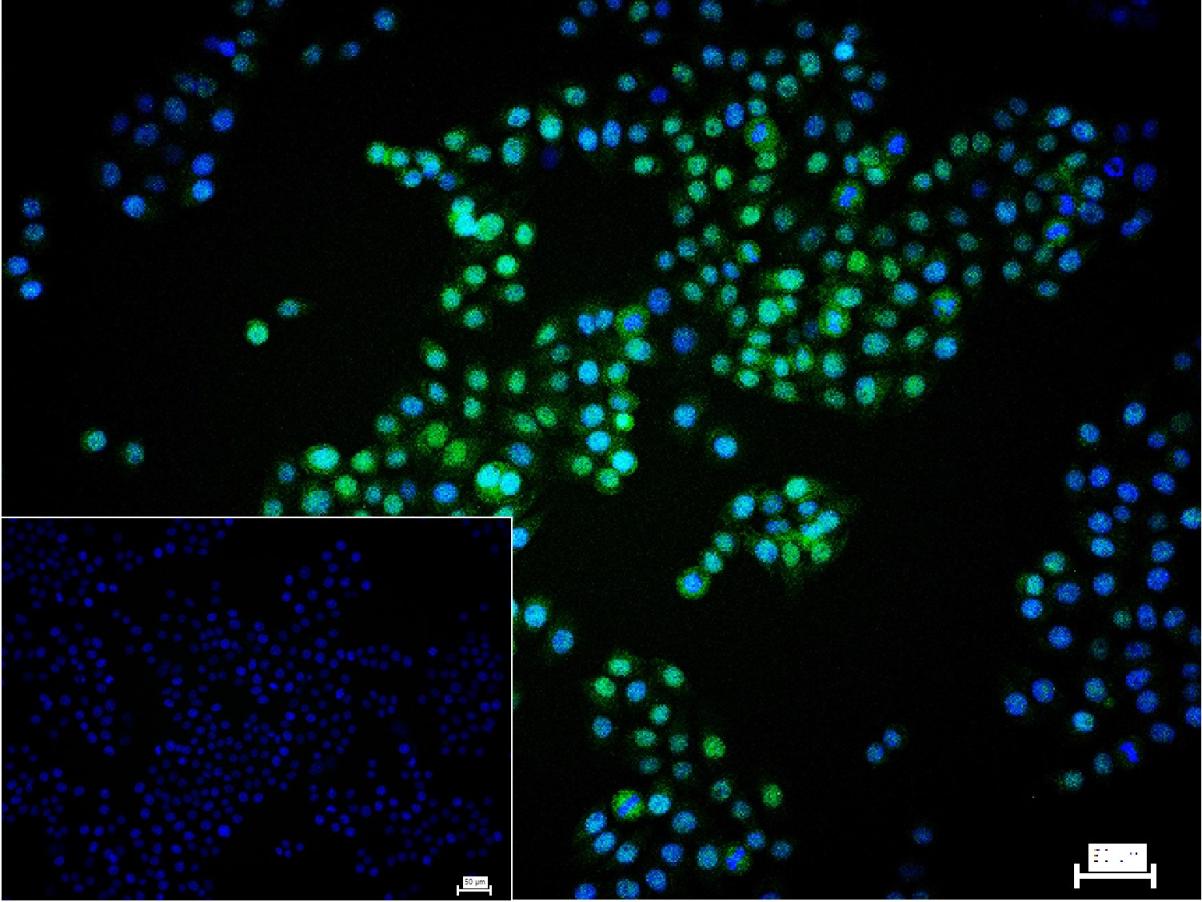 周期素依赖性激酶4重组兔单抗