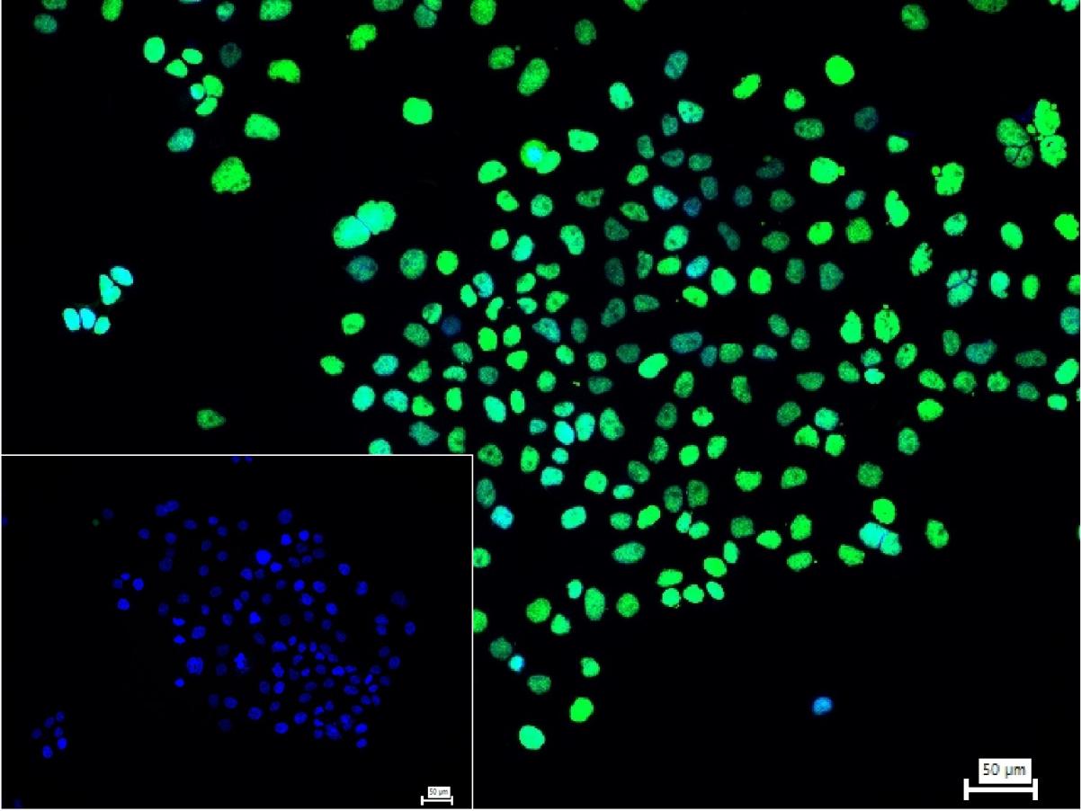 配对盒基因8重组兔单抗