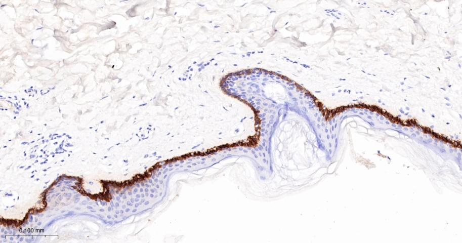 胶原蛋白17重组兔单抗