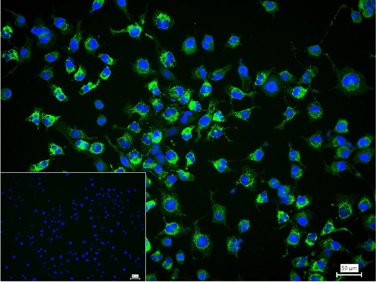 Ⅲ型胶原蛋白重组兔单抗