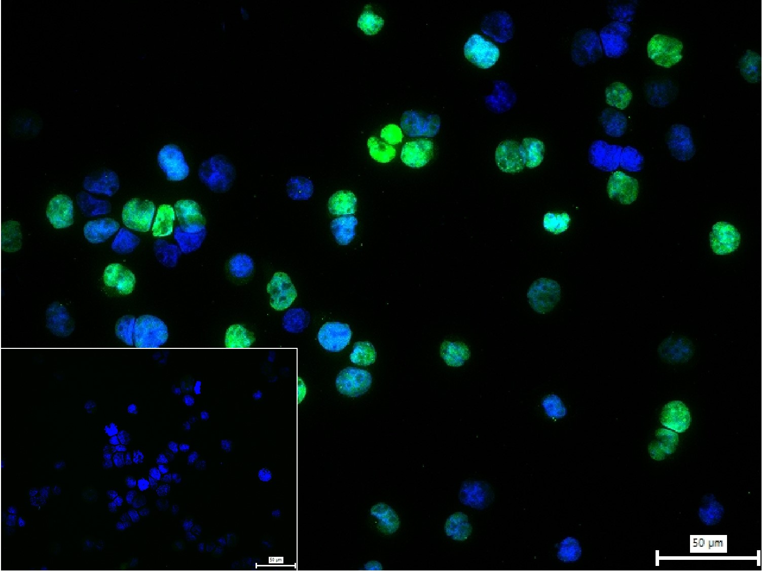 珠蛋白转录因子1抗体