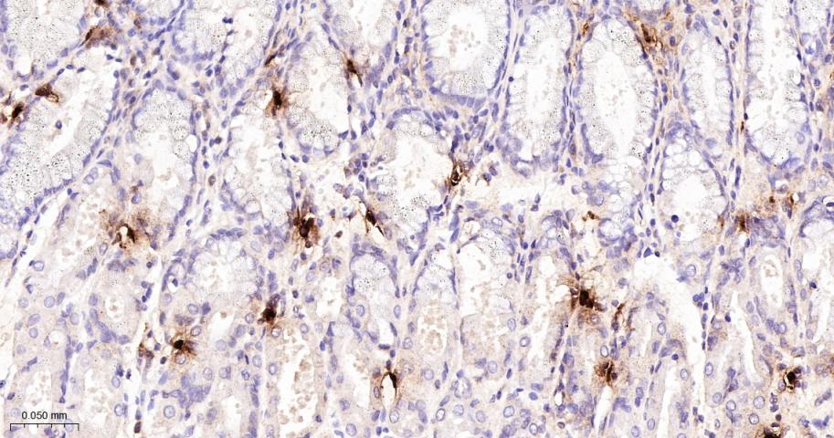 肥大细胞类胰蛋白酶重组兔单抗