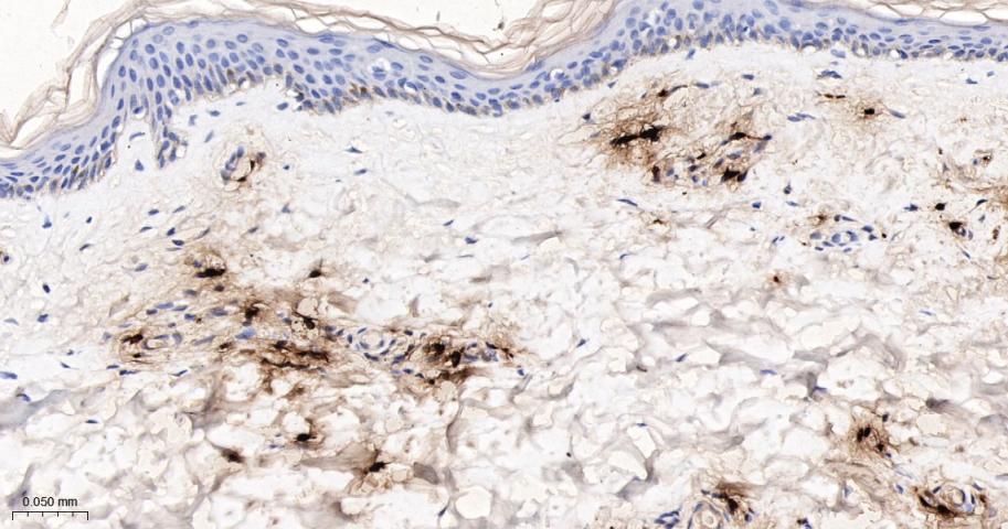 肥大细胞类胰蛋白酶重组兔单抗