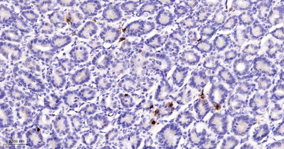 肥大细胞类胰蛋白酶重组兔单抗