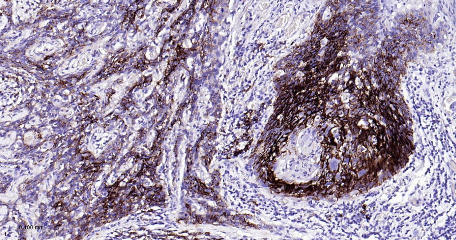 多配体蛋白聚糖1（CD138）重组兔单抗