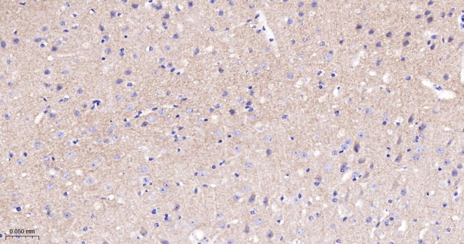 磷酸化酪氨酸激酶B(Tyr817)重组兔单抗