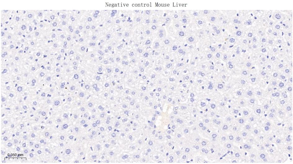 磷酸化酪氨酸激酶B(Tyr817)重组兔单抗