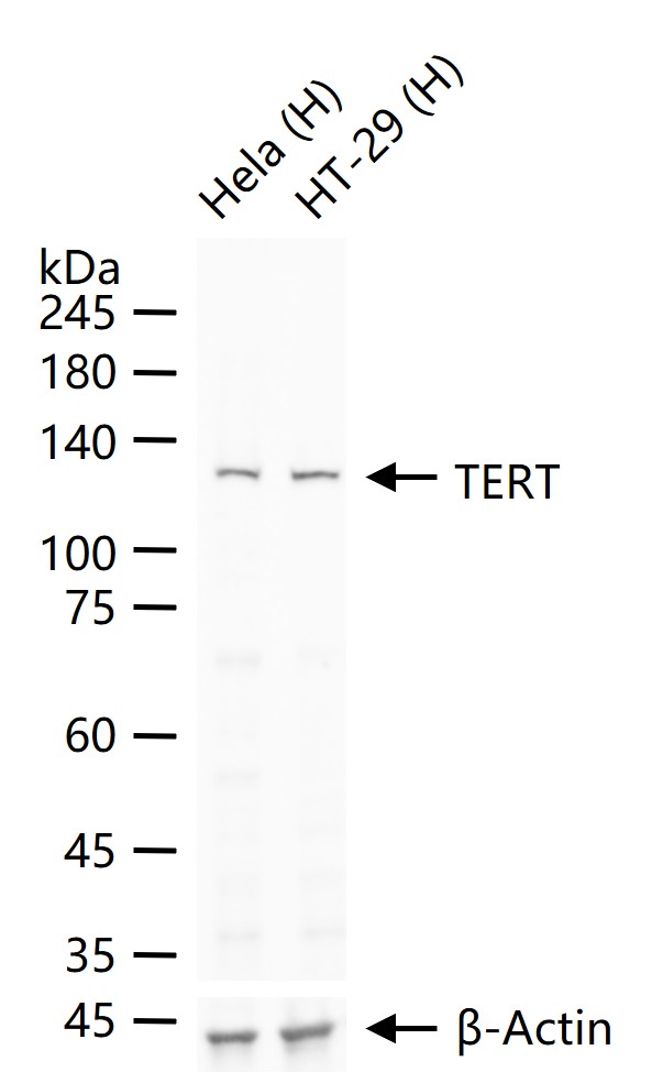 TERT Rabbit pAb (一抗) - WB,ELISA | Bioss