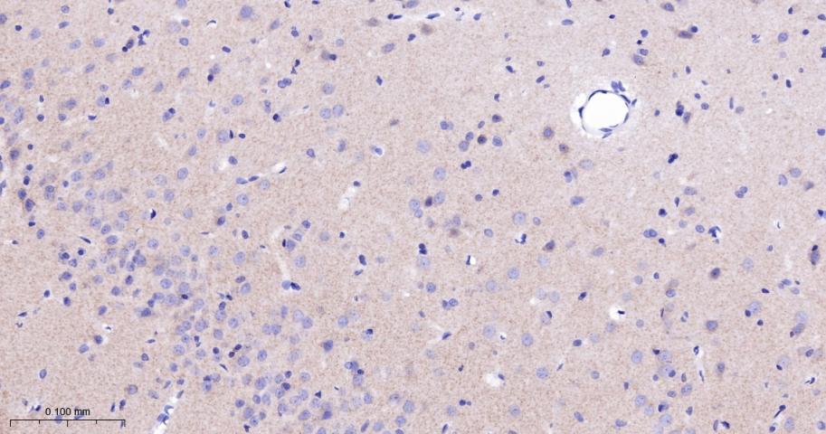 磷酸化酪氨酸激酶B(Tyr817)重组兔单抗