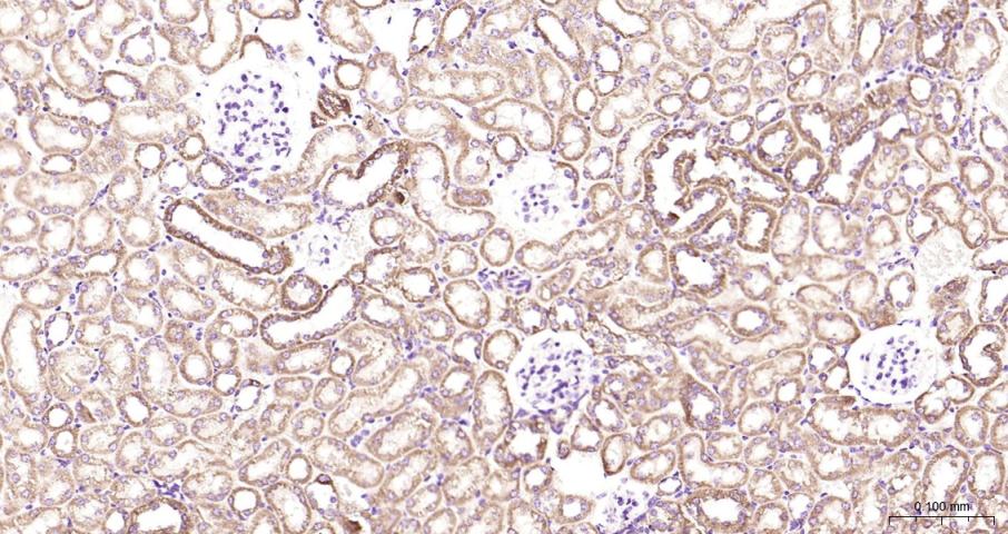 骨钙蛋白/骨钙素抗体-bs-4917R