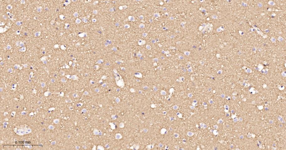 G蛋白β2重组兔单抗/鸟嘌呤核苷酸结合蛋白β亚基2重组兔单抗