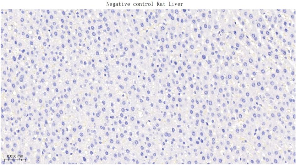 磷酸化酪氨酸激酶B(Tyr817)重组兔单抗