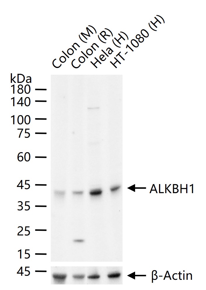 ALKBH1蛋白重组兔单抗