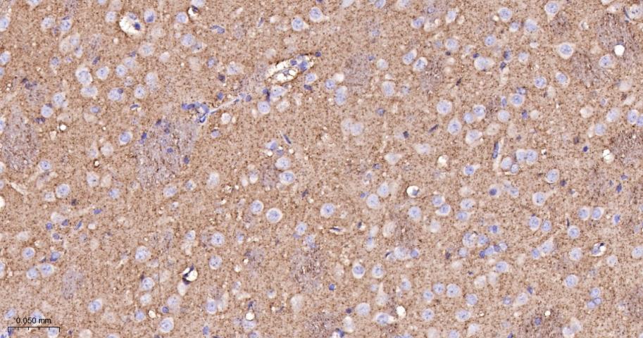 G蛋白β2重组兔单抗/鸟嘌呤核苷酸结合蛋白β亚基2重组兔单抗