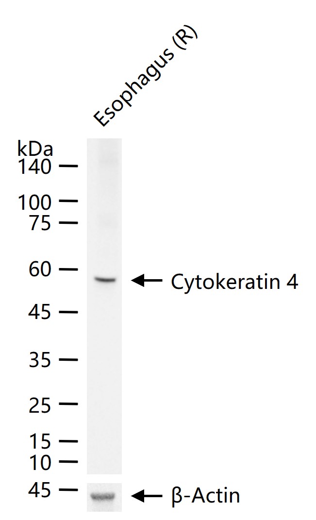 细胞角蛋白4重组兔单抗