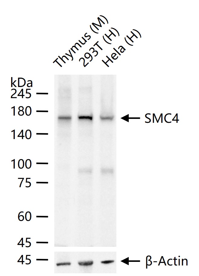 SMC4 Recombinant Rabbit mAb (一抗) - WB,Flow-Cyt,ICC/IF | Bioss