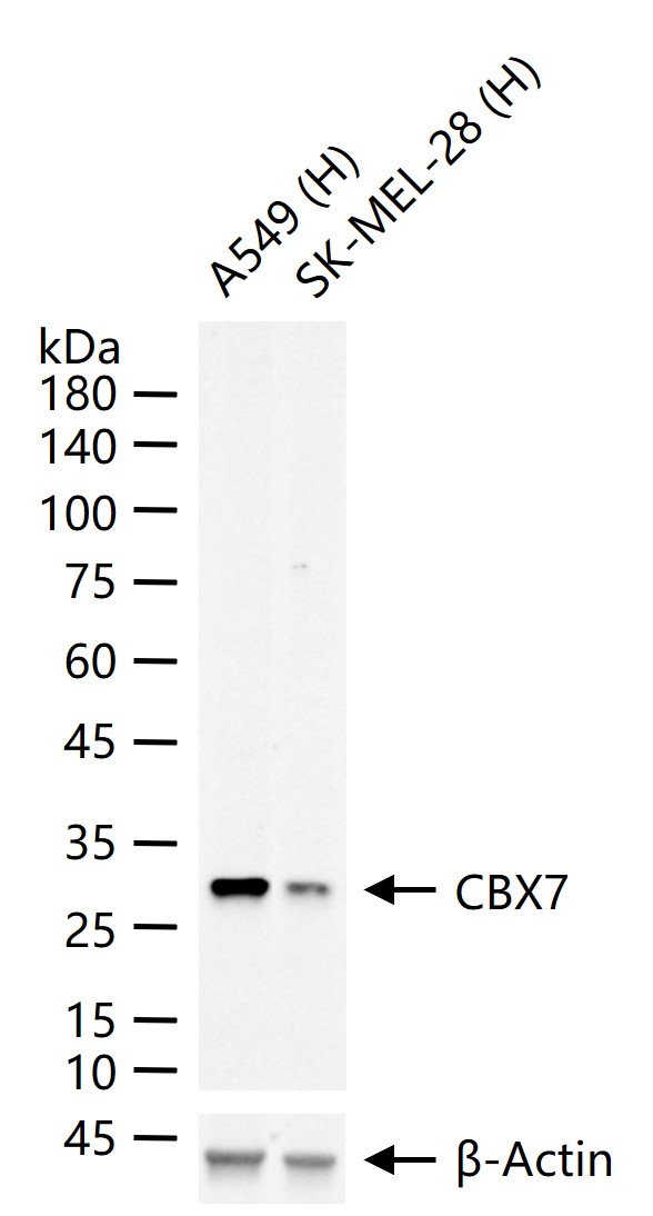 CBX7蛋白重组兔单抗