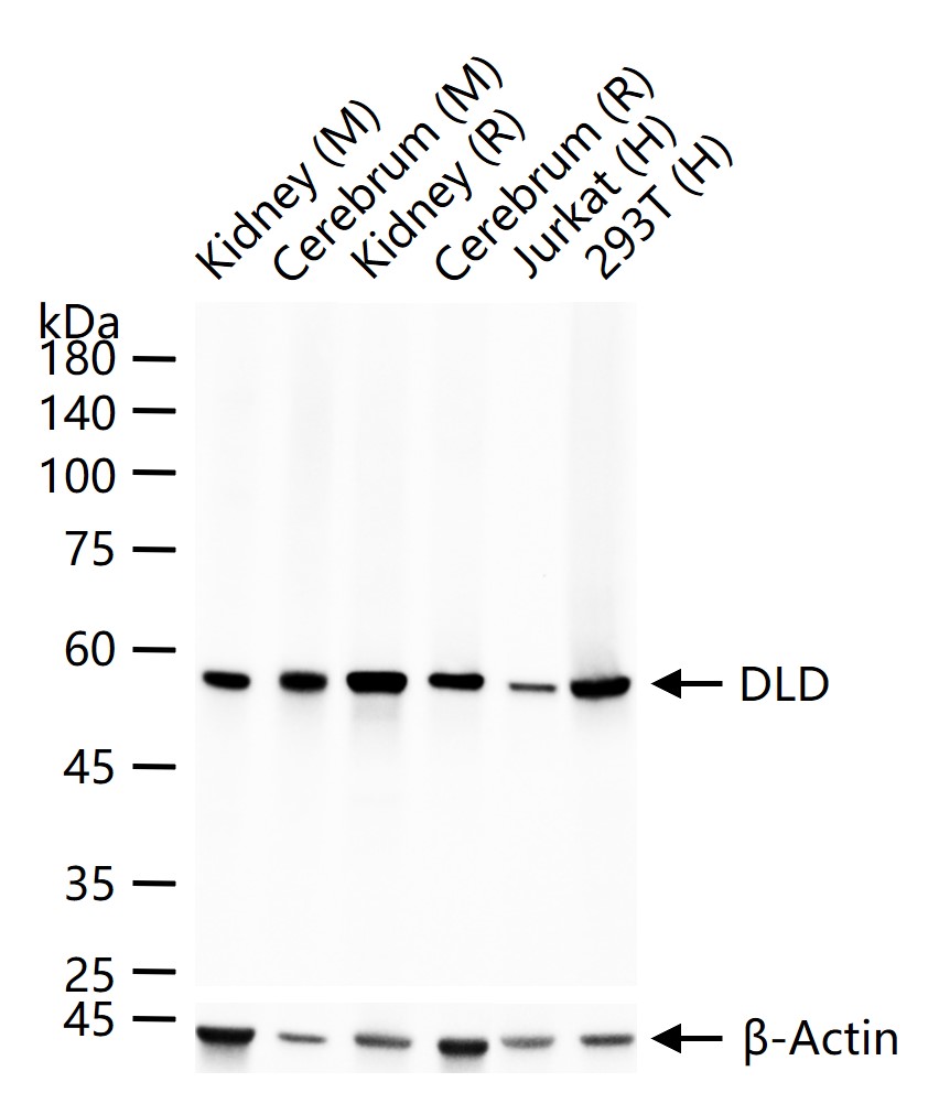 硫辛酰胺脱氢酶重组兔单抗