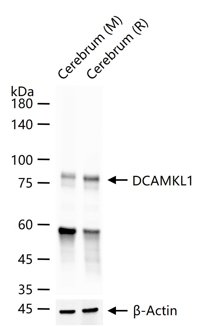 丝氨酸/苏氨酸蛋白激酶DCAMKL1重组兔单抗