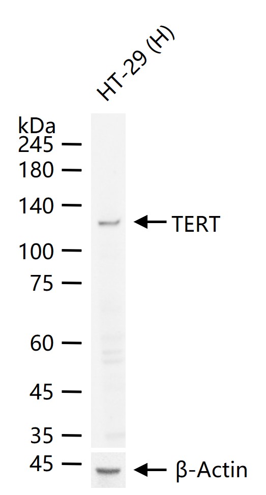 TERT Rabbit pAb (一抗) - WB,IHC-P,IHC-F,IF,Flow-Cyt | Bioss