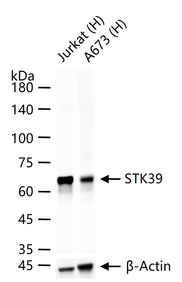 丝氨酸/苏氨酸蛋白激酶39重组兔单抗