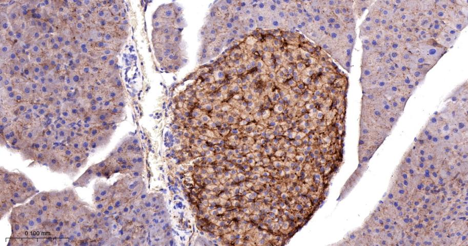 G蛋白β2重组兔单抗/鸟嘌呤核苷酸结合蛋白β亚基2重组兔单抗