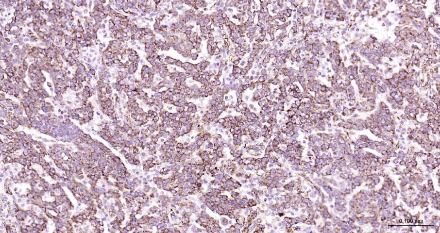 骨钙蛋白/骨钙素抗体-bs-4917R