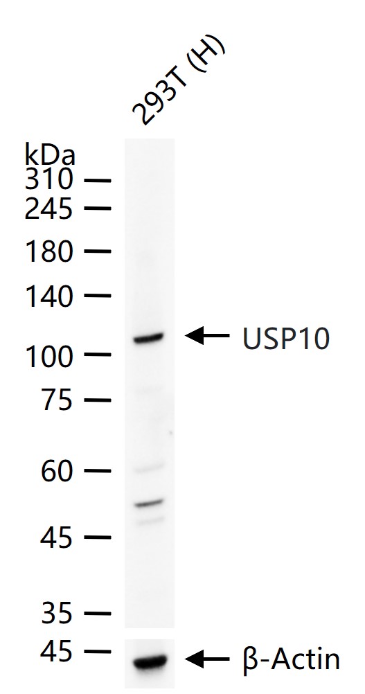去泛素酶10重组兔单抗