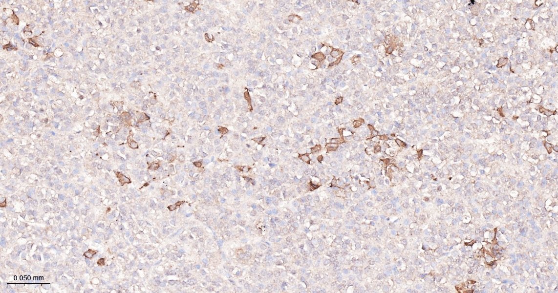 促甲状腺素β亚单位重组兔单抗