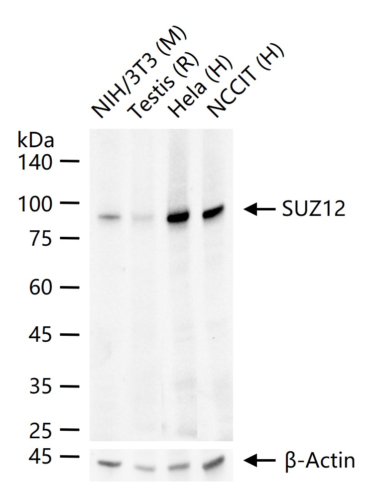 胚胎干细胞抑制蛋白Suz12重组兔单抗
