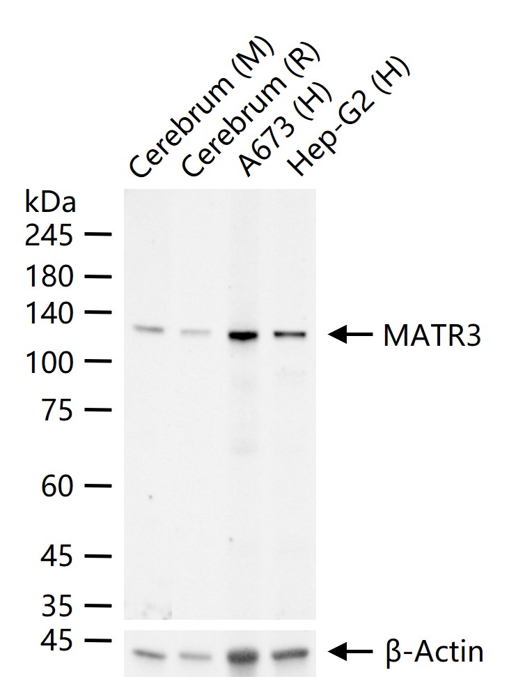 核基质蛋白3重组兔单抗