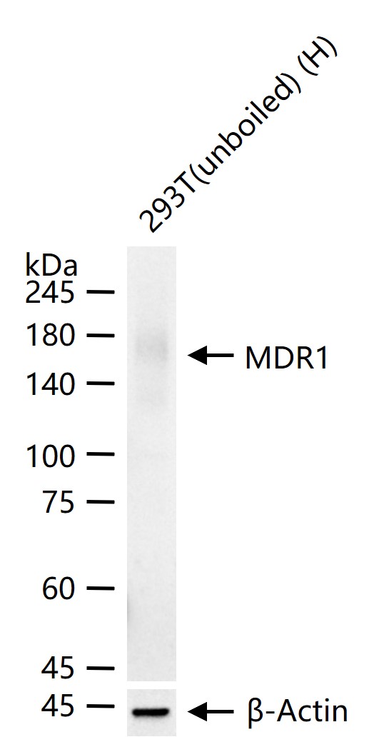 MDR1 Rabbit pAb (一抗) - WB,IHC-P,IHC-F,IF | Bioss