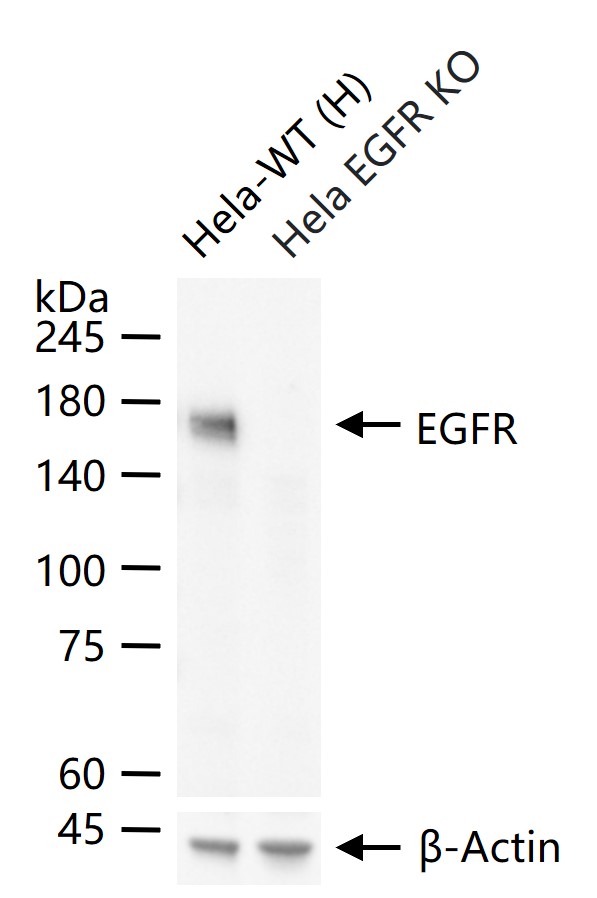 EGFR Mouse mAb (一抗) - WB,IHC-P,IHC-F,IF,ICC/IF | Bioss
